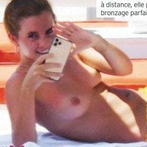 EMMA WATSON TOPLESS NUDE SUNBATHING PHOTOS PUBLISHED IN FRANCE thothub - France on chickinfo.com